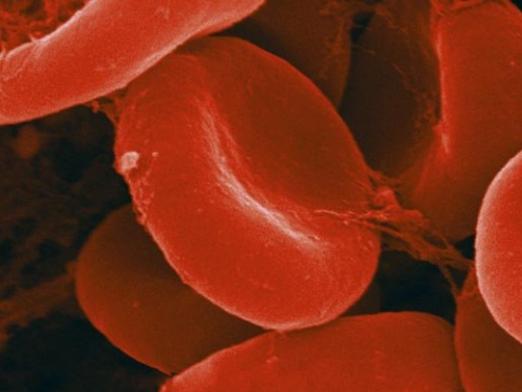 Vad är risken för lågt hemoglobin?